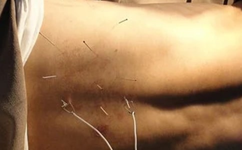 针灸科实习自我鉴定